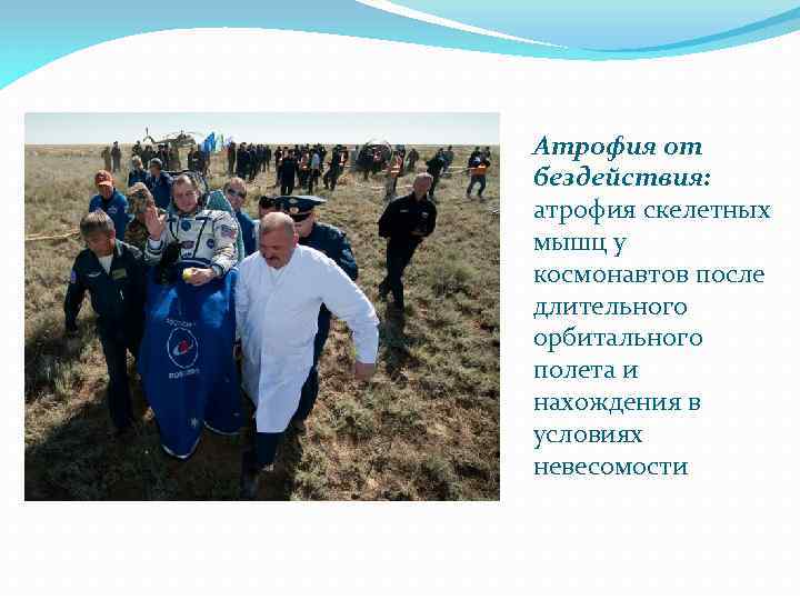 Атрофия от бездействия: атрофия скелетных мышц у космонавтов после длительного орбитального полета и нахождения