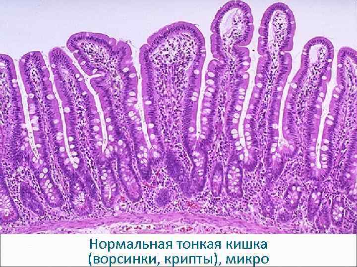 Нормальная тонкая кишка (ворсинки, крипты), микро 