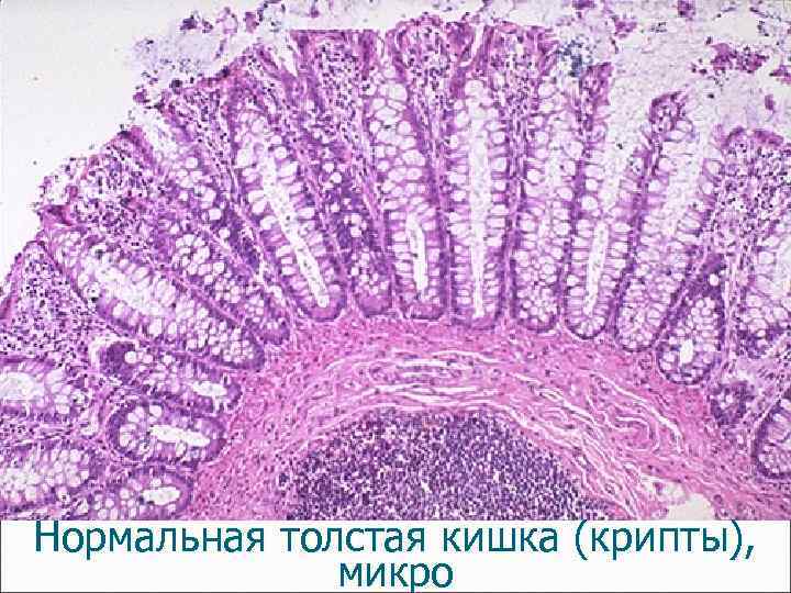 Нормальная толстая кишка (крипты), микро 