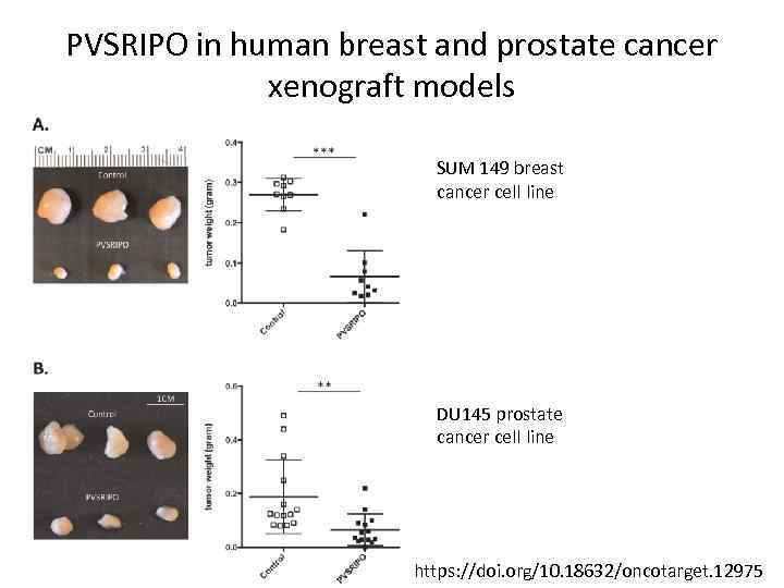 PVSRIPO in human breast and prostate cancer xenograft models SUM 149 breast cancer cell