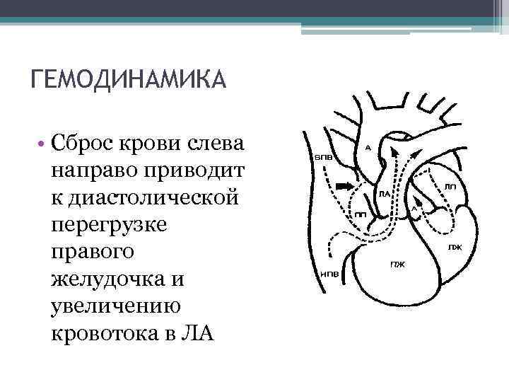 ГЕМОДИНАМИКА • Сброс крови слева направо приводит к диастолической перегрузке правого желудочка и увеличению