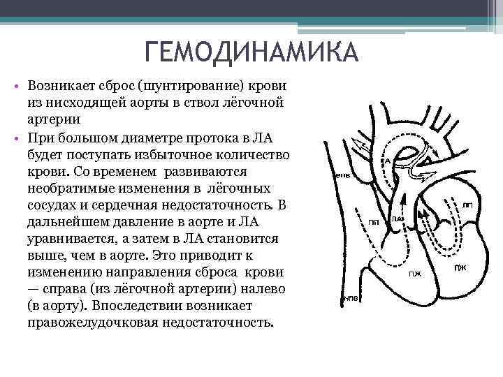 ГЕМОДИНАМИКА • Возникает сброс (шунтирование) крови из нисходящей аорты в ствол лёгочной артерии •