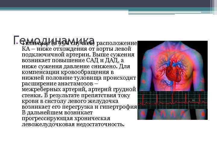 Гемодинамика расположение • Типичное (в 95% случаев) КА – ниже отхождения от аорты левой