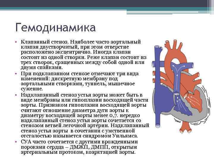 Гемодинамика • Клапанный стеноз. Наиболее часто аортальный клапан двустворчатый, при этом отверстие расположено эксцентрично.