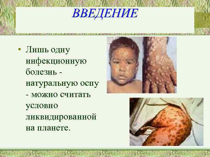 ВВЕДЕНИЕ • Лишь одну инфекционную болезнь натуральную оспу - можно считать условно ликвидированной на