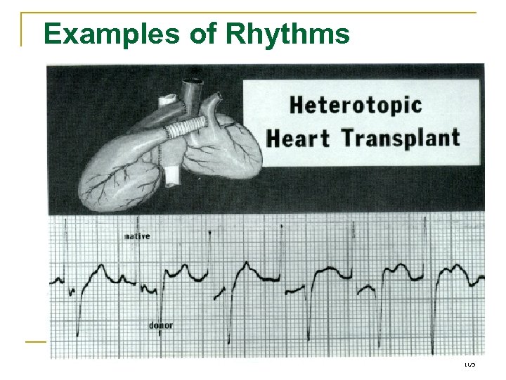 Examples of Rhythms 105 