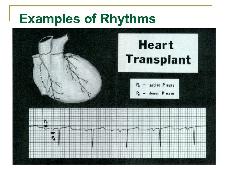 Examples of Rhythms 106 