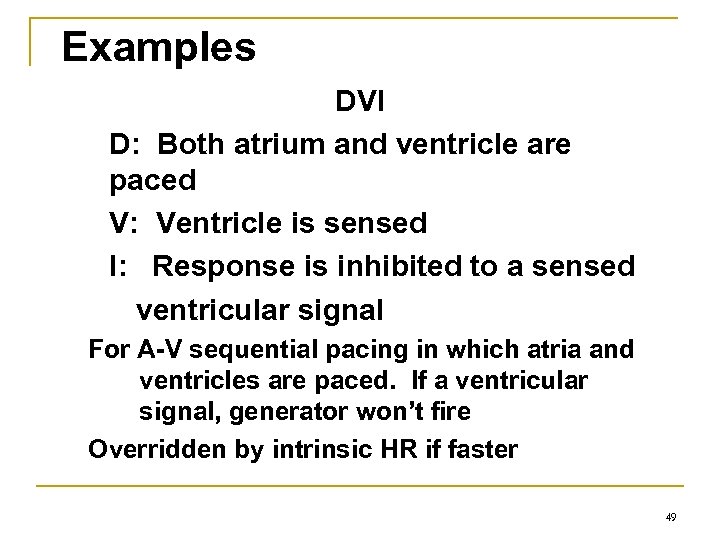 Examples DVI D: Both atrium and ventricle are paced V: Ventricle is sensed I: