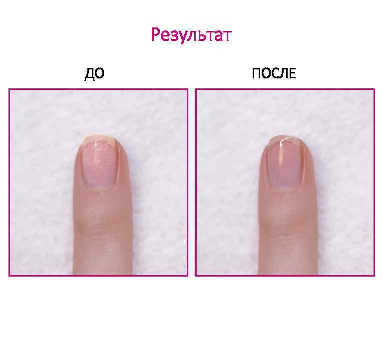 Результат ДО ПОСЛЕ 
