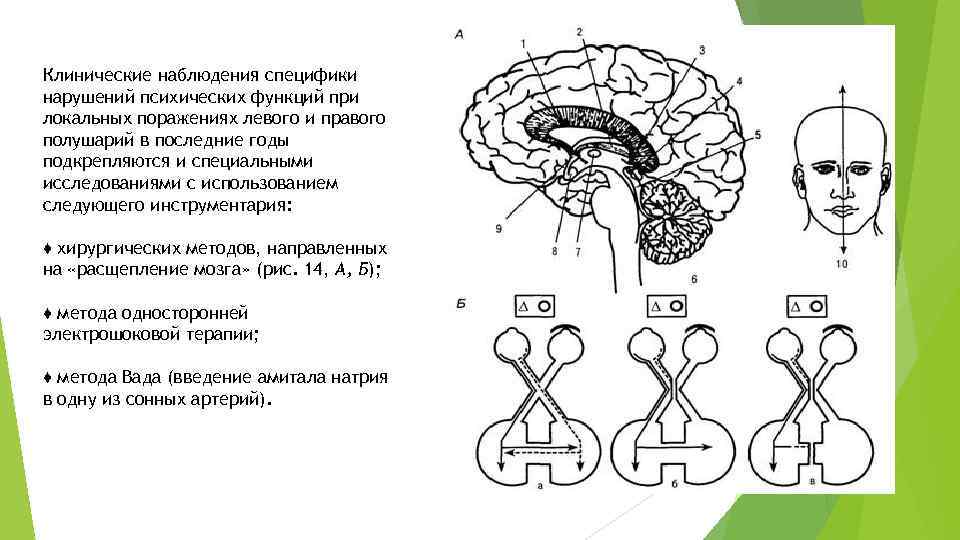 Клинические наблюдения специфики нарушений психических функций при локальных поражениях левого и правого полушарий в