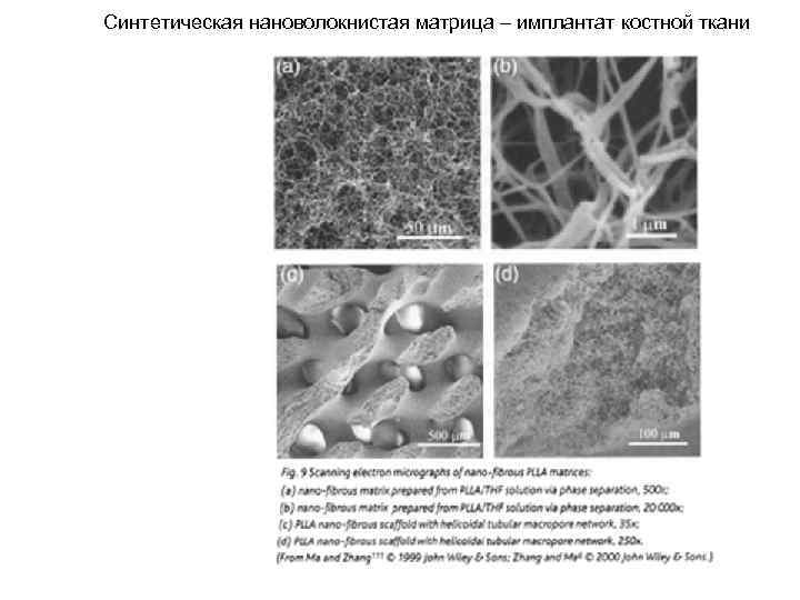Синтетическая нановолокнистая матрица – имплантат костной ткани 