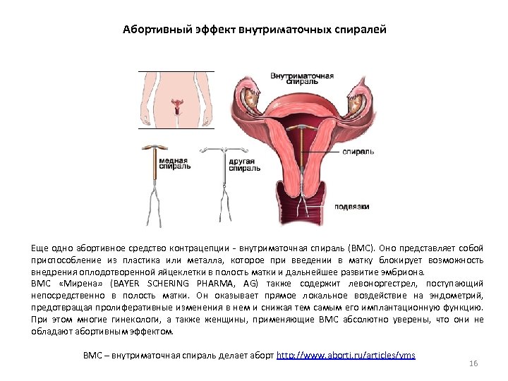 Абортивный эффект внутриматочных спиралей Еще одно абортивное средство контрацепции - внутриматочная спираль (ВМС). Оно