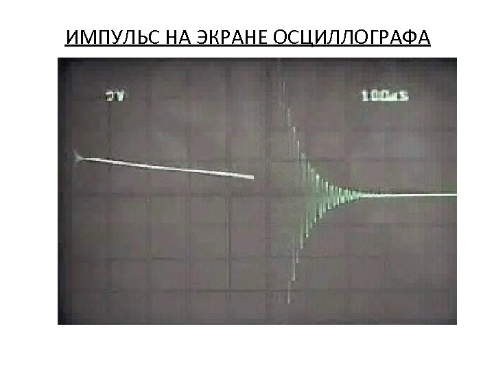 ИМПУЛЬС НА ЭКРАНЕ ОСЦИЛЛОГРАФА 