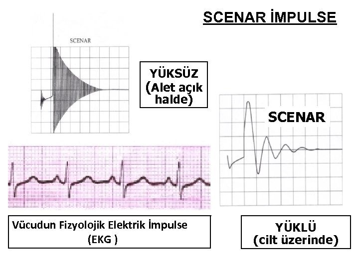 SCENAR İMPULSE YÜKSÜZ (Alet açık halde) SCENAR Vücudun Fizyolojik Elektrik İmpulse (EKG ) YÜKLÜ