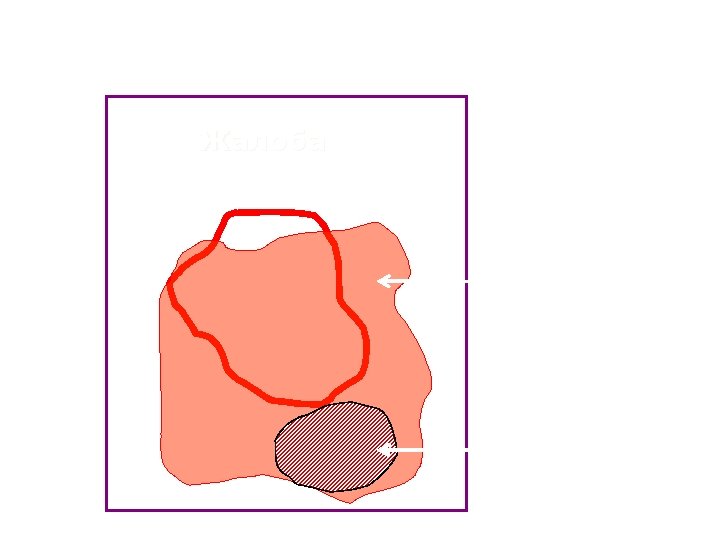 Асимметрия и Малая Асимметрия Жалоба Покраснение Прилипание 