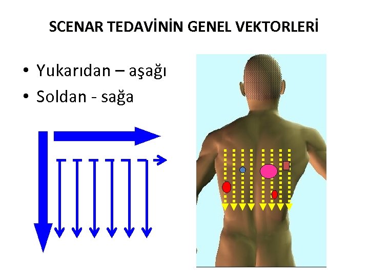SCENAR TEDAVİNİN GENEL VEKTORLERİ • Yukarıdan – aşağı • Soldan - sağa 