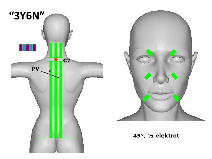 “ 3 Y 6 N” С 7 PV 45°, ½ elektrot 