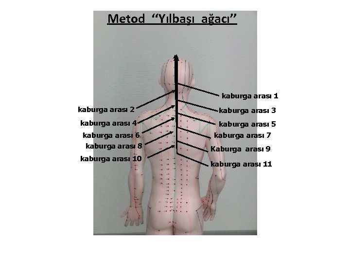 Metod ‘‘Yılbaşı ağacı’’ kaburga arası 1 kaburga arası 2 kaburga arası 4 kaburga arası
