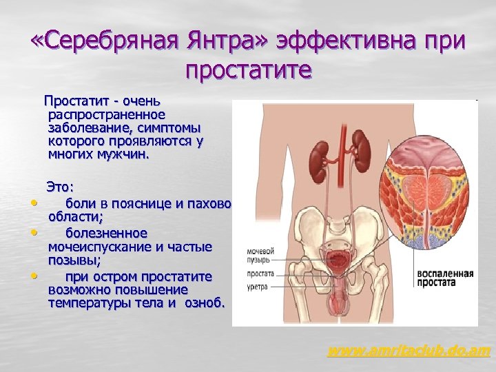 Может ли болеть простатит. Боли при простатите у мужчин. Боли при остром простатите. Боль при хроническом простатите.