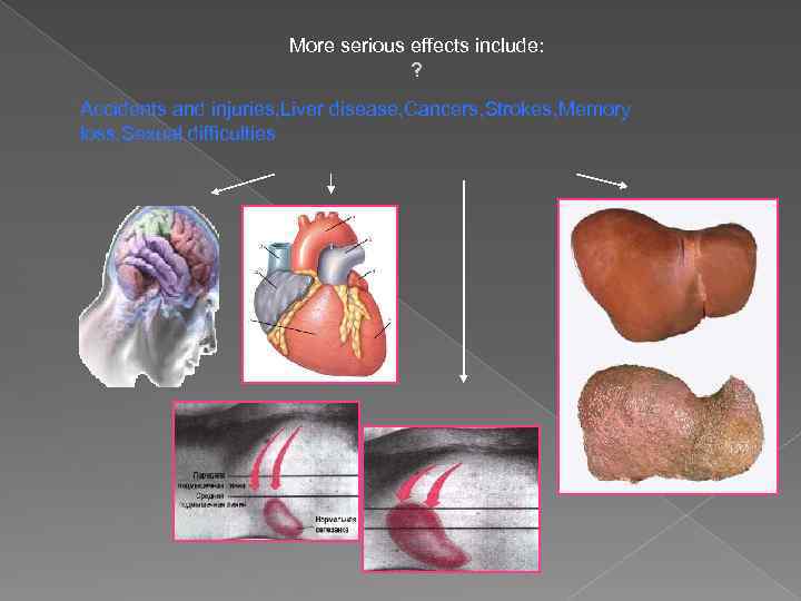 More serious effects include: ? Accidents and injuries, Liver disease, Cancers, Strokes, Memory loss,