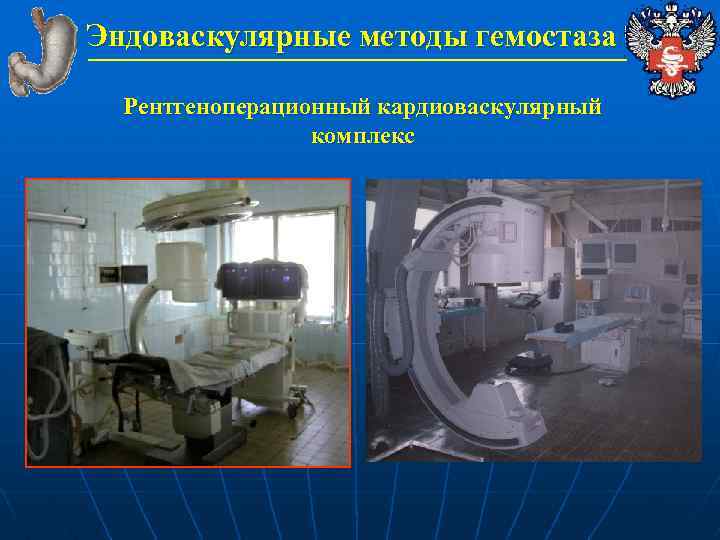 Эндоваскулярные методы гемостаза Рентгеноперационный кардиоваскулярный комплекс 