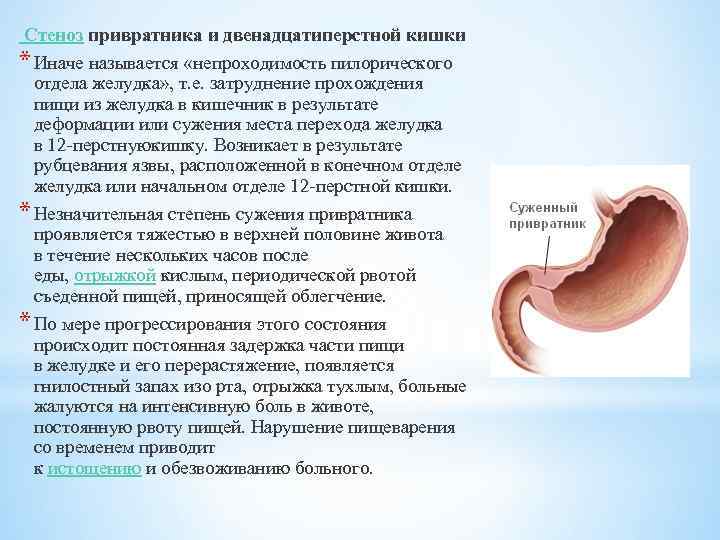  Стеноз привратника и двенадцатиперстной кишки * Иначе называется «непроходимость пилорического отдела желудка» ,