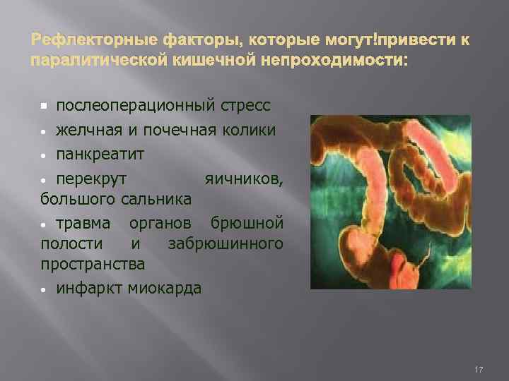 Рефлекторные факторы, которые могут привести к паралитической кишечной непроходимости: послеоперационный стресс • желчная и