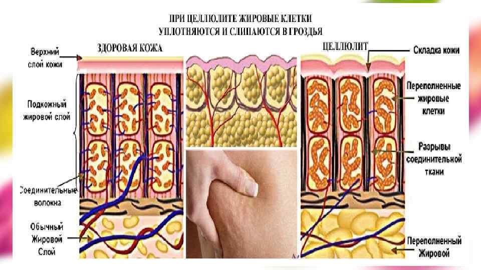 Для начала нам необходимо создать… УСЛОВИЯ ДЛЯ СНИЖЕНИЯ ВЕСА ТРАТЬТЕ БОЛЬШЕ КАЛОРИЙ ПОТРЕБЛЯЙТЕ МЕНЬШЕ