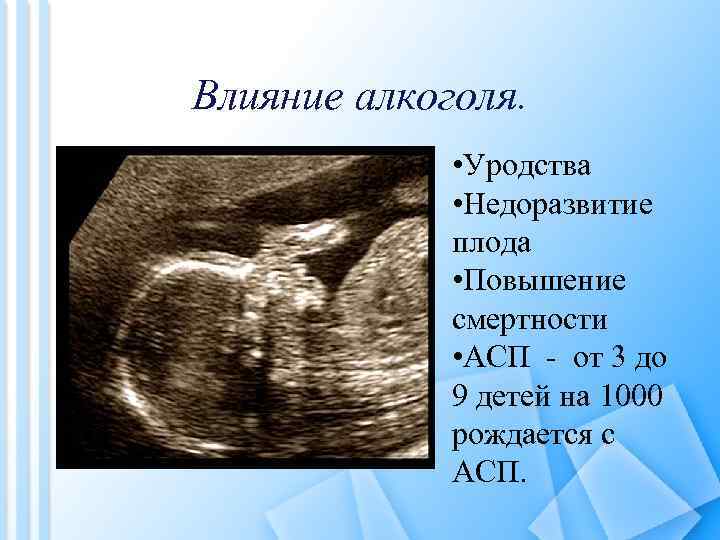 Влияние алкоголя. • Уродства • Недоразвитие плода • Повышение смертности • АСП - от