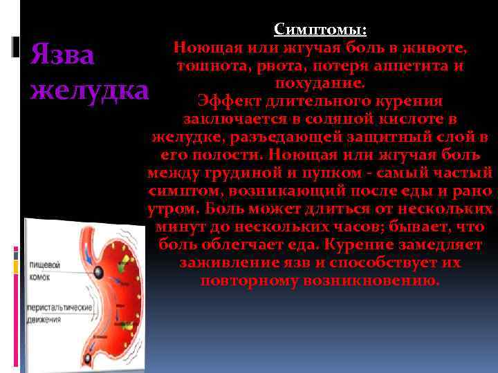 Симптомы: Ноющая или жгучая боль в животе, тошнота, рвота, потеря аппетита и похудание. Эффект