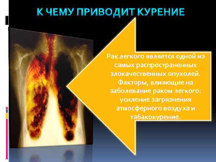 Рак легкого является одной из самых распространенных злокачественных опухолей. Факторы, влияющие на заболевание раком