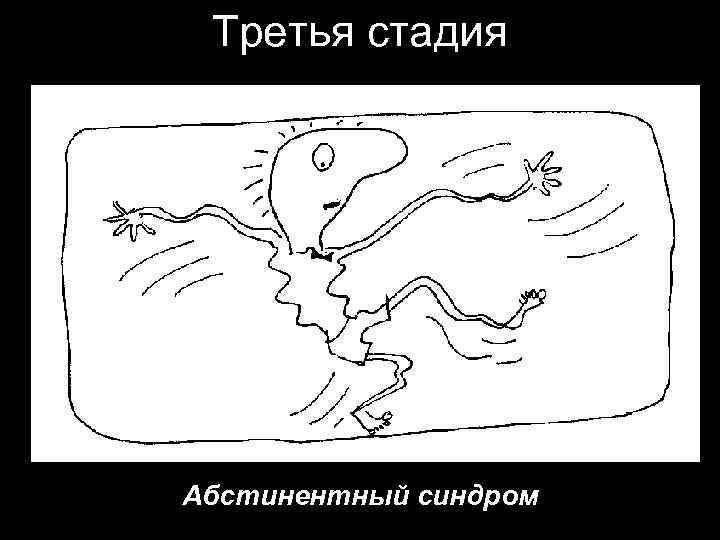 Третья стадия Абстинентный синдром 