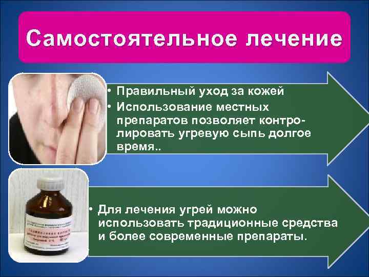 Самостоятельное лечение • Правильный уход за кожей • Использование местных препаратов позволяет контролировать угревую
