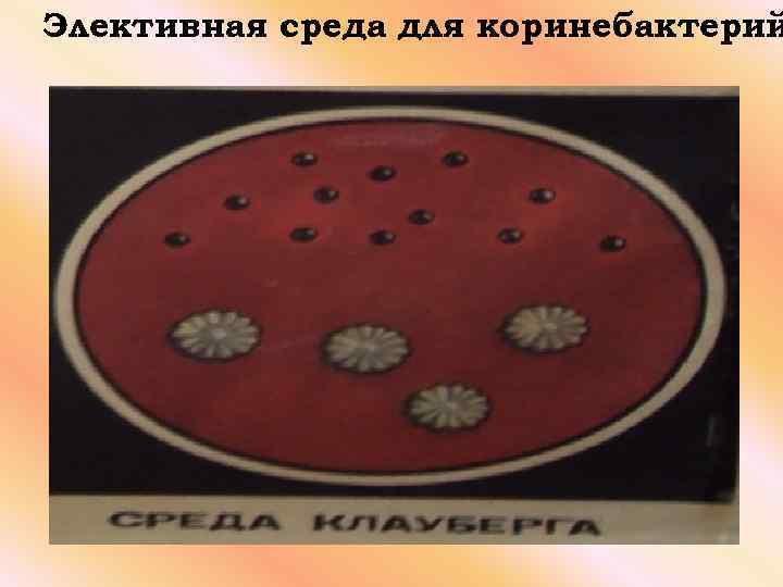 Элективная среда для коринебактерий 