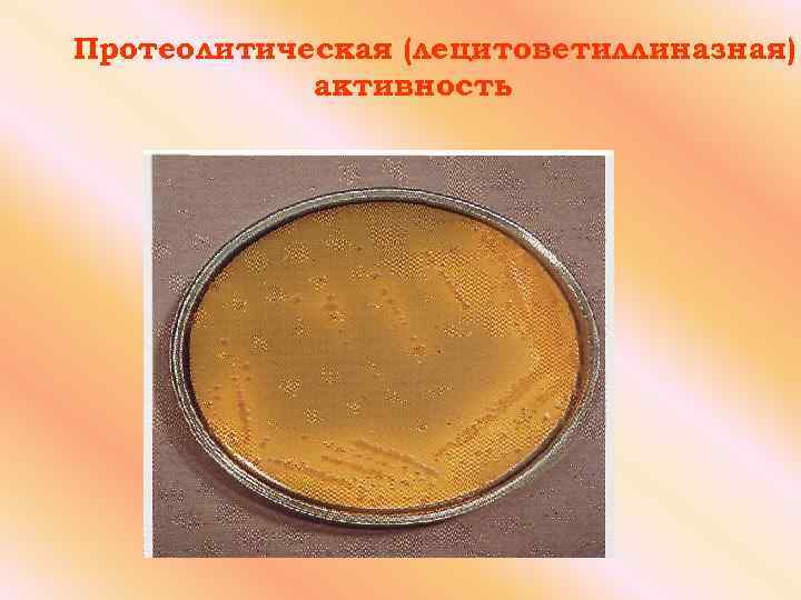 Протеолитическая (лецитоветиллиназная) активность 