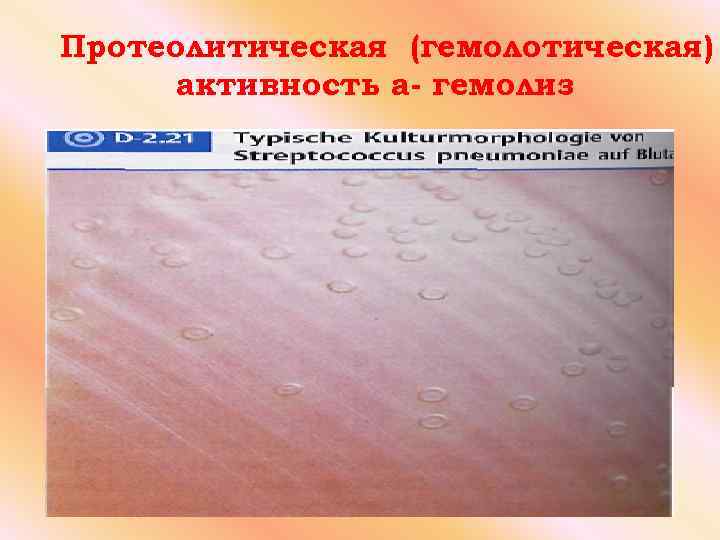 Протеолитическая (гемолотическая) активность а- гемолиз 
