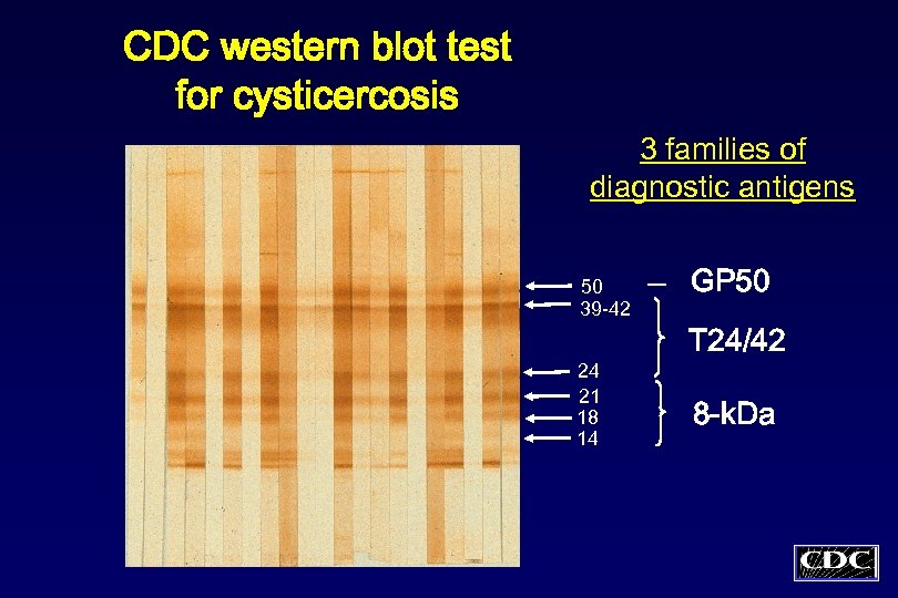 CDC western blot test for cysticercosis 3 families of diagnostic antigens 50 39 -42