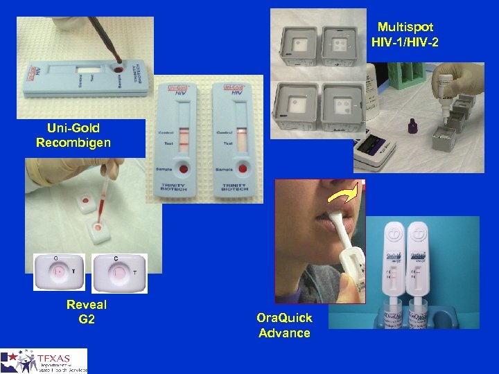 Multispot HIV-1/HIV-2 Uni-Gold Recombigen Reveal G 2 Ora. Quick Advance 