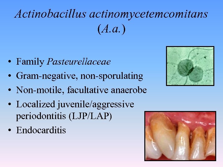 Actinobacillus actinomycetemcomitans (A. a. ) • • Family Pasteurellaceae Gram-negative, non-sporulating Non-motile, facultative anaerobe