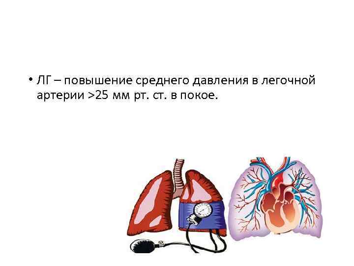  • ЛГ – повышение среднего давления в легочной артерии >25 мм рт. ст.