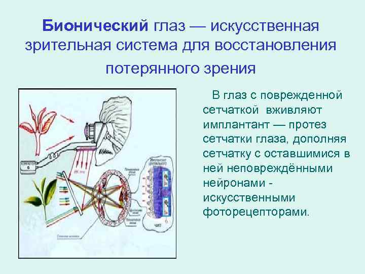Бионический глаз — искусственная зрительная система для восстановления потерянного зрения В глаз с поврежденной