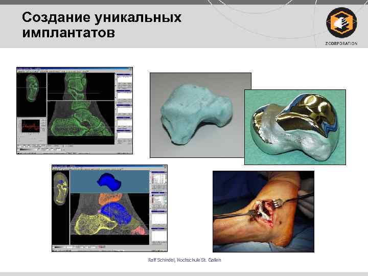 Создание уникальных имплантатов Ralf Schindel, Hochschule St. Gallen Schindel, 