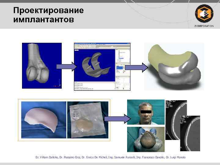 Проектирование имплантантов Dr. Villiam Dallolio, Dr. Massimo Orsi, Dr. Enrico De Micheli, Ing. Samuele
