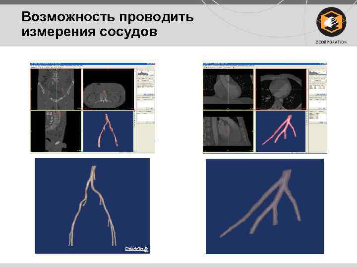 Возможность проводить измерения сосудов 