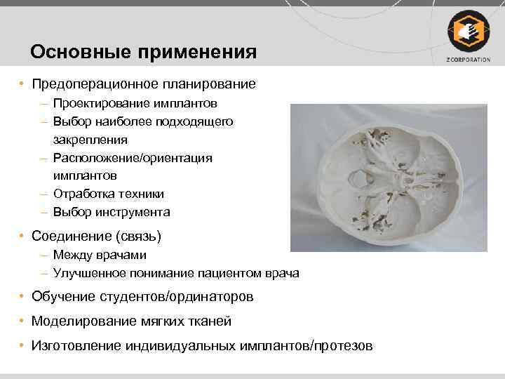 Основные применения • Предоперационное планирование – Проектирование имплантов – Выбор наиболее подходящего закрепления –