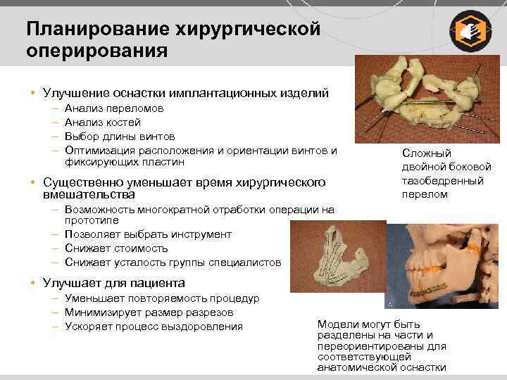 Планирование хирургической оперирования • Улучшение оснастки имплантационных изделий – – Анализ переломов Анализ костей