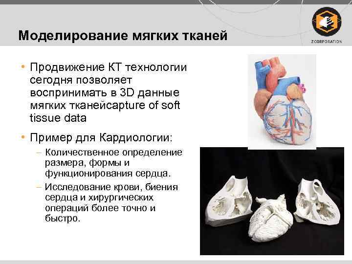 Моделирование мягких тканей • Продвижение КТ технологии сегодня позволяет воспринимать в 3 D данные