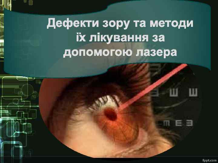 Дефекти зору та методи їх лікування за допомогою лазера 