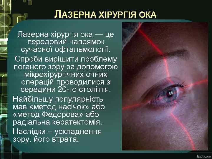 ЛАЗЕРНА ХІРУРГІЯ ОКА Лазерна хірургія ока — це передовий напрямок сучасної офтальмології. Спроби вирішити