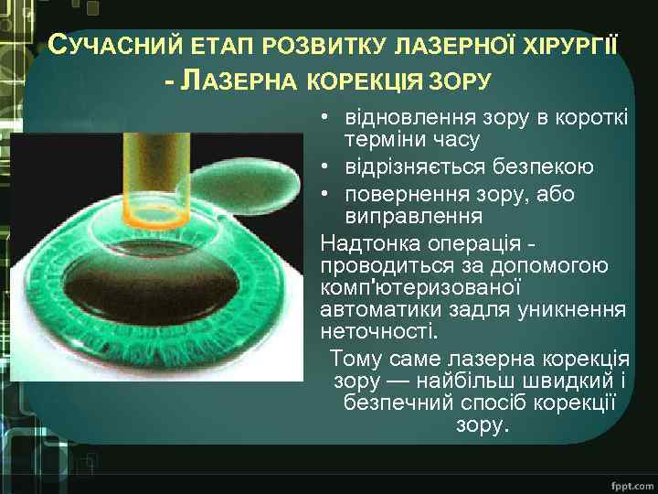 СУЧАСНИЙ ЕТАП РОЗВИТКУ ЛАЗЕРНОЇ ХІРУРГІЇ - ЛАЗЕРНА КОРЕКЦІЯ ЗОРУ • відновлення зору в короткі
